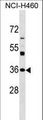 NAT6 / FUS2 Antibody - NAT6 Antibody western blot of NCI-H460 cell line lysates (35 ug/lane). The NAT6 antibody detected the NAT6 protein (arrow).