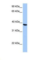 NAT6 / FUS2 Antibody - HepG2 cell lysate. Antibody concentration: 1.0 ug/ml. Gel concentration: 12%.  This image was taken for the unconjugated form of this product. Other forms have not been tested.