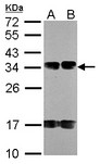 NAT6 / FUS2 Antibody - Sample (30 ug of whole cell lysate). A: A431 , B: H1299. 12% SDS PAGE. NAT6 / FUS2 antibody diluted at 1:1000.