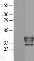NAT6 / FUS2 Protein - Western validation with an anti-DDK antibody * L: Control HEK293 lysate R: Over-expression lysate