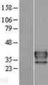 NAT6 / FUS2 Protein - Western validation with an anti-DDK antibody * L: Control HEK293 lysate R: Over-expression lysate