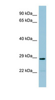 NAT8B Antibody - NAT8B antibody Western blot of THP-1 cell lysate. This image was taken for the unconjugated form of this product. Other forms have not been tested.