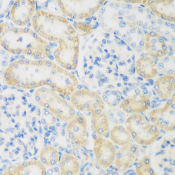 NAT8B Antibody - Immunohistochemistry of paraffin-embedded rat kidney tissue.