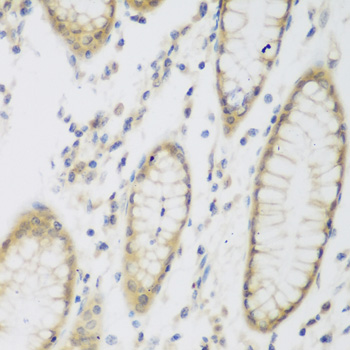 NAT8B Antibody - Immunohistochemistry of paraffin-embedded human stomach tissue.