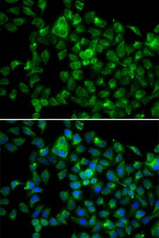 NAT8B Antibody - Immunofluorescence analysis of A549 cells.