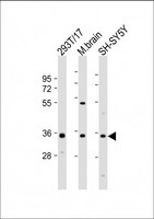 NAT8L Antibody - All lanes: Anti-NAT8L Antibody (N-Term) at 1:2000 dilution. Lane 1: 293T/17 whole cell lysate. Lane 2: mouse brain lysate. Lane 3: SH-SY5Y whole cell lysate Lysates/proteins at 20 ug per lane. Secondary Goat Anti-Rabbit IgG, (H+L), Peroxidase conjugated at 1:10000 dilution. Predicted band size: 33 kDa. Blocking/Dilution buffer: 5% NFDM/TBST.