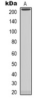 NAV1 Antibody - Western blot analysis of NAV1 expression in MCF7 (A) whole cell lysates.