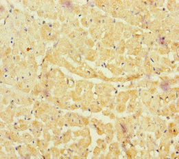 NBAS / NAG Antibody - Immunohistochemistry of paraffin-embedded human heart tissue at dilution of 1:100