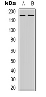 NBEAL1 Antibody - Western blot analysis of NBEAL1 expression in HEK293T (A); HepG2 (B) whole cell lysates.