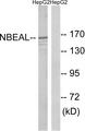 NBEAL1 Antibody - Western blot analysis of extracts from HepG2 cells, using NBEAL1 antibody.