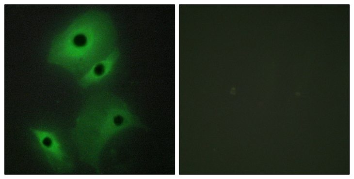 NBL1 / DAN Antibody - Immunofluorescence analysis of HeLa cells, using NBL1 Antibody. The picture on the right is blocked with the synthesized peptide.