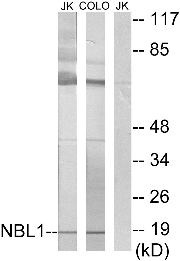 NBL1 / DAN Antibody - Western blot analysis of lysates from Jurkat and COLO cells, using NBL1 Antibody. The lane on the right is blocked with the synthesized peptide.