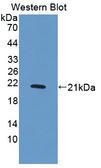 NBL1 / DAN Antibody - Western blot of NBL1 / DAN antibody.