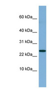 NBL1 / DAN Antibody - NBL1 antibody Western blot of Fetal Lung lysate. This image was taken for the unconjugated form of this product. Other forms have not been tested.