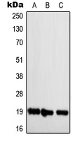 NBL1 / DAN Antibody - Western blot analysis of NBL1 expression in Jurkat (A); Raw264.7 (B); H9C2 (C) whole cell lysates.