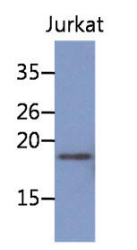 NBL1 / DAN Antibody - Western Blot: The cell lysate of Jurkat (30 ug) were resolved by SDS-PAGE, transferred to PVDF membrane and probed with anti-human NBL1 antibody (1:1000). Proteins were visualized using a goat anti-mouse secondary antibody conjugated to HRP and an ECL detection system.