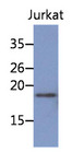 NBL1 / DAN Antibody - Western Blot: The cell lysate of Jurkat (30 ug) were resolved by SDS-PAGE, transferred to PVDF membrane and probed with anti-human NBL1 antibody (1:1000). Proteins were visualized using a goat anti-mouse secondary antibody conjugated to HRP and an ECL detection system.
