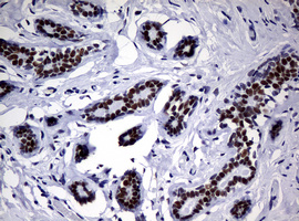 NBN / Nibrin Antibody - IHC of paraffin-embedded Human breast tissue using anti-NBN mouse monoclonal antibody.