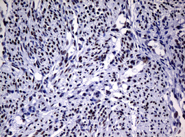 NBN / Nibrin Antibody - IHC of paraffin-embedded Human endometrium tissue using anti-NBN mouse monoclonal antibody.