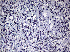 NBN / Nibrin Antibody - IHC of paraffin-embedded Human Ovary tissue using anti-NBN mouse monoclonal antibody.