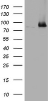 NBN / Nibrin Antibody - HEK293T cells were transfected with the pCMV6-ENTRY control (Left lane) or pCMV6-ENTRY NBN (Right lane) cDNA for 48 hrs and lysed. Equivalent amounts of cell lysates (5 ug per lane) were separated by SDS-PAGE and immunoblotted with anti-NBN.