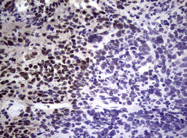 NBN / Nibrin Antibody - IHC of paraffin-embedded Human breast tissue using anti-NBN mouse monoclonal antibody.