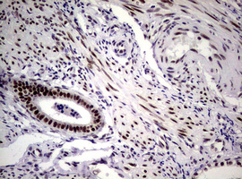 NBN / Nibrin Antibody - IHC of paraffin-embedded Human endometrium tissue using anti-NBN mouse monoclonal antibody.