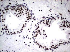 NBN / Nibrin Antibody - IHC of paraffin-embedded Human prostate tissue using anti-NBN mouse monoclonal antibody.