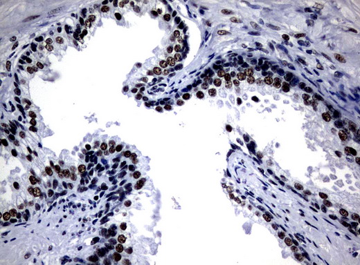 NBN / Nibrin Antibody - Immunohistochemical staining of paraffin-embedded Human prostate tissue using anti-NBN mouse monoclonal antibody.  heat-induced epitope retrieval by 10mM citric buffer, pH6.0, 120C for 3min)