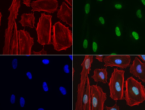 NBN / Nibrin Antibody - Immunofluorescent staining of HeLa cells using anti-NBN mouse monoclonal antibody  green, 1:50). Actin filaments were labeled with Alexa Fluor® 594 Phalloidin. (red), and nuclear with DAPI. (blue).