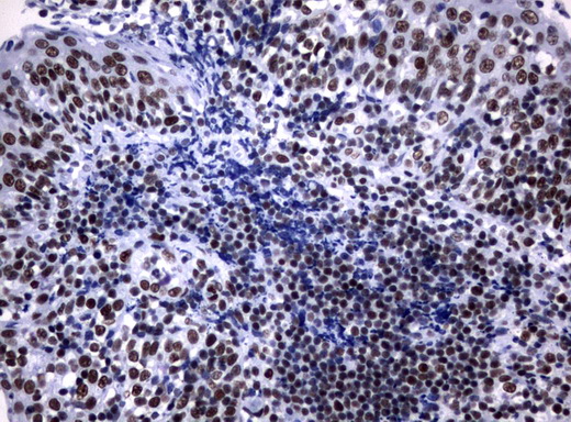 NBN / Nibrin Antibody - Immunohistochemical staining of paraffin-embedded Human tonsil using anti-NBN mouse monoclonal antibody.  heat-induced epitope retrieval by 10mM citric buffer, pH6.0, 120C for 3min)