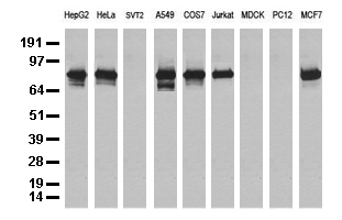 NBN / Nibrin Antibody - Western blot analysis of extracts. (35ug) from 9 different cell lines by using anti-NBN monoclonal antibody. (Clone UMAB100).