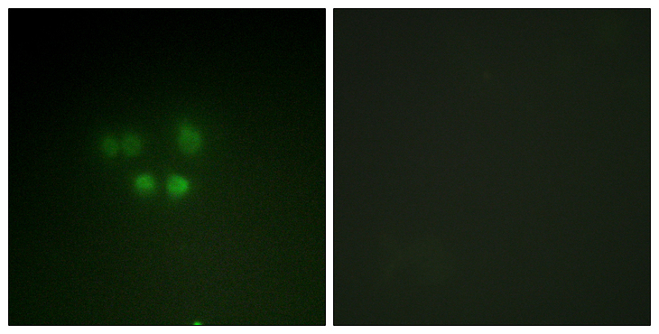 NBN / Nibrin Antibody - Immunofluorescence analysis of A549 cells, using Nibrin Antibody. The picture on the right is blocked with the synthesized peptide.