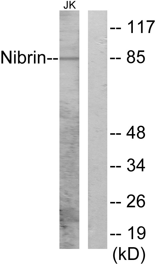 NBN / Nibrin Antibody - Western blot analysis of lysates from Jurkat cells, using Nibrin Antibody. The lane on the right is blocked with the synthesized peptide.