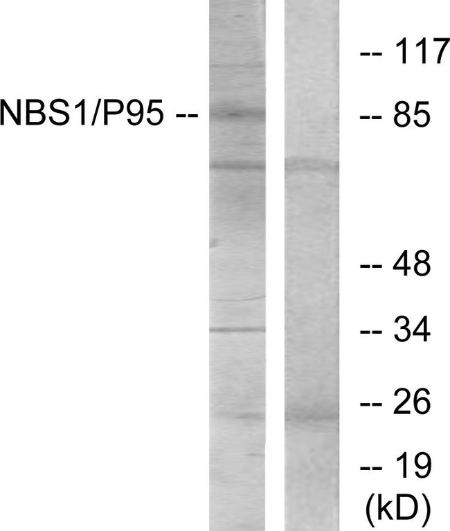 NBN / Nibrin Antibody - Western blot analysis of lysates from Jurkat cells, using p95/NBS1 Antibody. The lane on the right is blocked with the synthesized peptide.