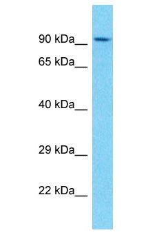 NBN / Nibrin Antibody - NBN/ NBS1 / Nibrin antibody Western Blot of HCT15. Antibody dilution: 3 ug/ml.  This image was taken for the unconjugated form of this product. Other forms have not been tested.