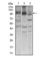 NBN / Nibrin Antibody - Western Blot: NBS1 Antibody (7E4A2) - Western blot analysis using NBN mouse mAb against A549 (1), Jurkat (2) and PC-12 (3) cell lysate.