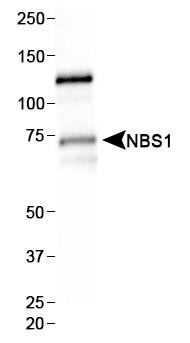 NBN / Nibrin Antibody - Western Blot: NBS1 Antibody (7E4A2) - Western blot analysis of NBS1 in HepG2 whole cell lysate.