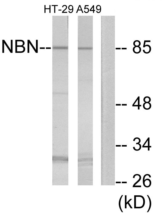 NBN / Nibrin Antibody - Western blot analysis of lysates from A549 and HT-29 cells, using NBN Antibody. The lane on the right is blocked with the synthesized peptide.