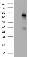 NBN / Nibrin Antibody - HEK293T cells were transfected with the pCMV6-ENTRY control (Left lane) or pCMV6-ENTRY NBN (Right lane) cDNA for 48 hrs and lysed. Equivalent amounts of cell lysates (5 ug per lane) were separated by SDS-PAGE and immunoblotted with anti-NBN.