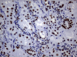 NBN / Nibrin Antibody - IHC of paraffin-embedded Human Kidney tissue using anti-NBN mouse monoclonal antibody.