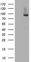 NBN / Nibrin Antibody - HEK293T cells were transfected with the pCMV6-ENTRY control (Left lane) or pCMV6-ENTRY NBN (Right lane) cDNA for 48 hrs and lysed. Equivalent amounts of cell lysates (5 ug per lane) were separated by SDS-PAGE and immunoblotted with anti-NBN.