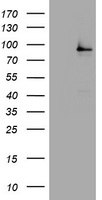 NBN / Nibrin Antibody - HEK293T cells were transfected with the pCMV6-ENTRY control (Left lane) or pCMV6-ENTRY NBN (Right lane) cDNA for 48 hrs and lysed. Equivalent amounts of cell lysates (5 ug per lane) were separated by SDS-PAGE and immunoblotted with anti-NBN.