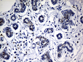 NBN / Nibrin Antibody - IHC of paraffin-embedded Human breast tissue using anti-NBN mouse monoclonal antibody.