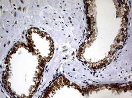 NBN / Nibrin Antibody - IHC of paraffin-embedded Human prostate tissue using anti-NBN mouse monoclonal antibody.