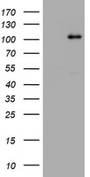 NBN / Nibrin Antibody - HEK293T cells were transfected with the pCMV6-ENTRY control (Left lane) or pCMV6-ENTRY NBN (Right lane) cDNA for 48 hrs and lysed. Equivalent amounts of cell lysates (5 ug per lane) were separated by SDS-PAGE and immunoblotted with anti-NBN.