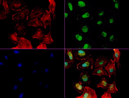 NBN / Nibrin Antibody - Immunofluorescent staining of A549 cells using NBN mouse monoclonal antibody  green). Actin filaments were labeled with TRITC-phalloidin. (red), and nuclear with DAPI. (blue). The three-color overlay image is located at the bottom-right corner.