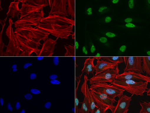 NBN / Nibrin Antibody - Immunofluorescent staining of HeLa cells using anti-NBN mouse monoclonal antibody  green, 1:100). Actin filaments were labeled with Alexa Fluor® 594 Phalloidin. (red), and nuclear with DAPI. (blue).