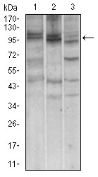 NBN / Nibrin Antibody - Western blot using NBN mouse monoclonal antibody against A549 (1), Jurkat (2) and PC-12 (3) cell lysate.