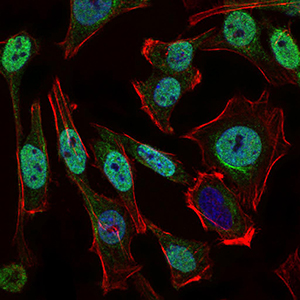 NBN / Nibrin Antibody - Immunofluorescence of HeLa cells using NBN mouse monoclonal antibody (green). Blue: DRAQ5 fluorescent DNA dye. Red: Actin filaments have been labeled with Alexa Fluor-555 phalloidin. Secondary antibody from Fisher (Cat#: 35503)